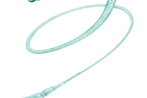 Микрокатетеры Vasco